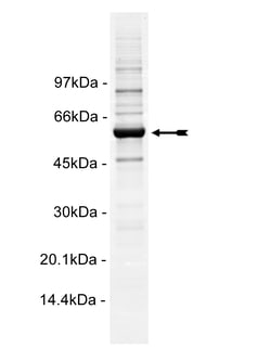 Eurofins DiscoverX Fgr Protein, Active 10 &mu;g | Buy Online | Eurofins DiscoverX | Fisher Scientific